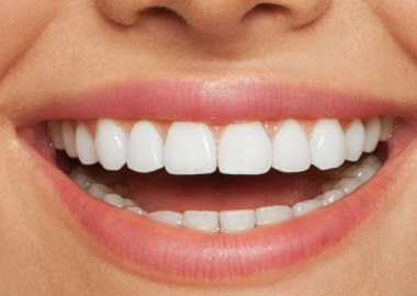 Diş Aralarında Biriken Plakları Azaltmada Arayüz Fırçasının Önemi