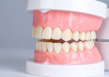 Diş Protezlerinde Leke Oluşumu Nasıl Önlenir?